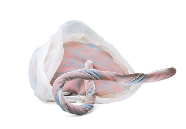 Model of Placenta & Umbilical