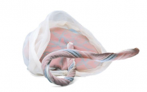 Model of Placenta & Umbilical